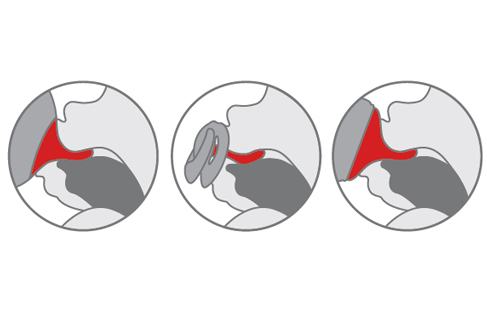 Tétine Nuk First Choice col étroit plate - Alimentation bébé 0-6 mois